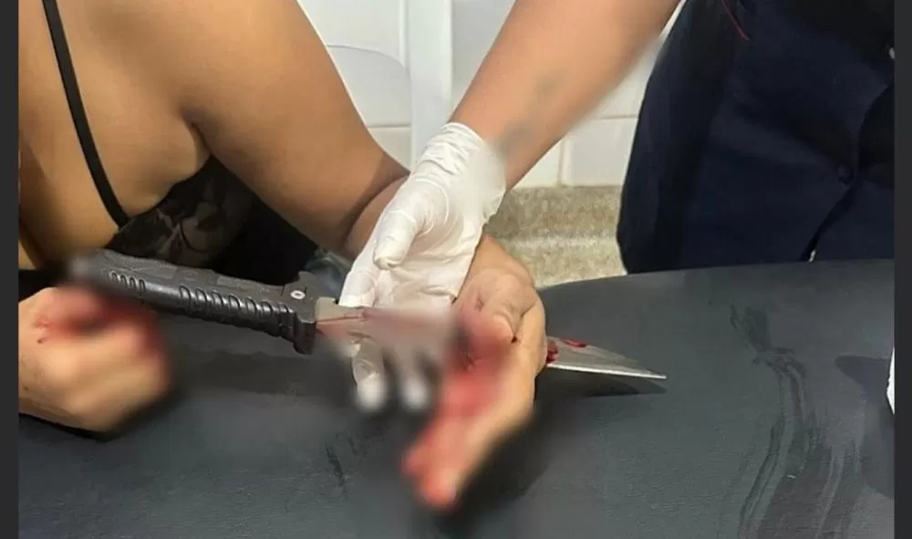 Vítima foi ferida na mão esquerda e precisou passar por cirurgia; Foto: Ligado Na Redação