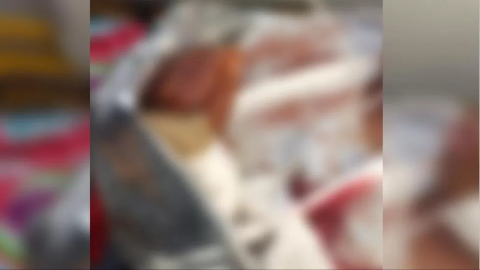 Vítima sofreu fratura exposta e perda de sangue (Arquivo pessoal)