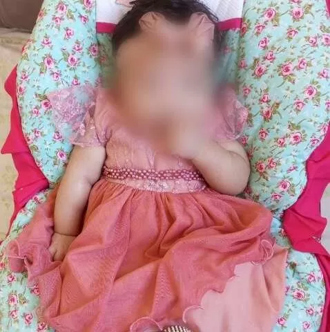 O braço direito de Eloah não tem movimento, e por isso ela precisa de cirurgia. (Foto: Direto das Ruas)