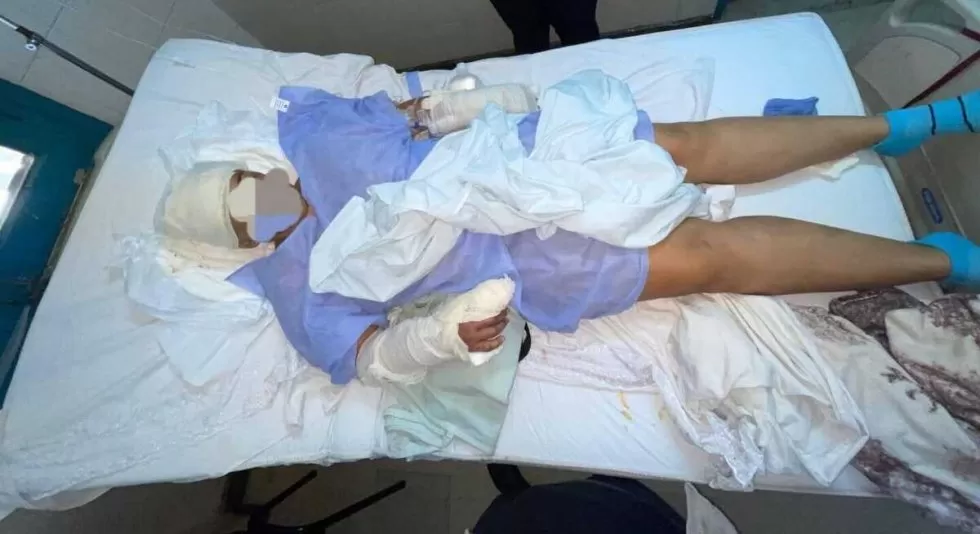 Mulher segue em recuperação no hospital / Nacionales RD